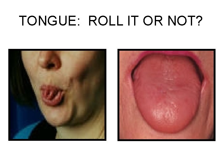 TONGUE: ROLL IT OR NOT? 