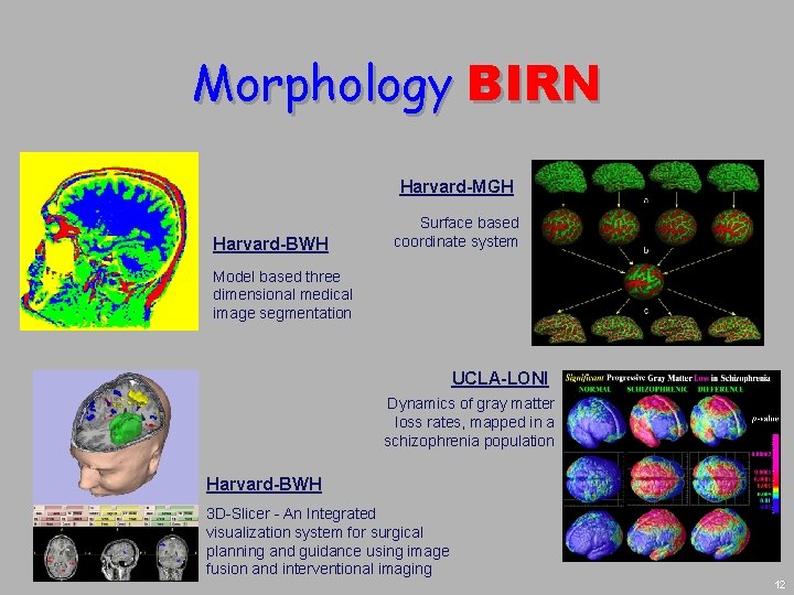 Morphology BIRN Harvard-MGH Harvard-BWH Surface based coordinate system Model based three dimensional medical image