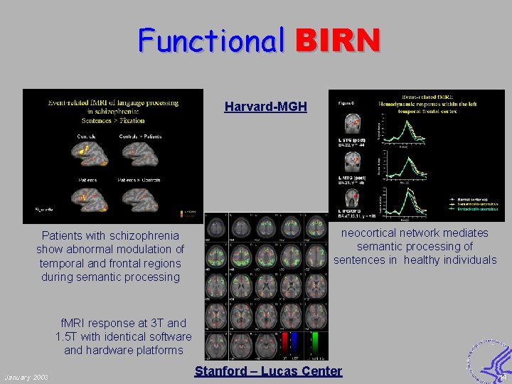 Functional BIRN Harvard-MGH Patients with schizophrenia show abnormal modulation of temporal and frontal regions