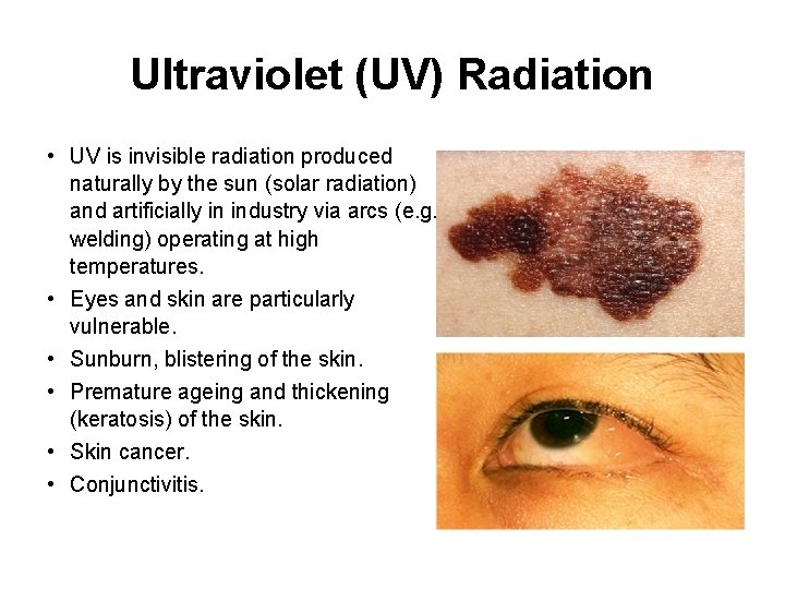 Ultraviolet (UV) Radiation • UV is invisible radiation produced naturally by the sun (solar