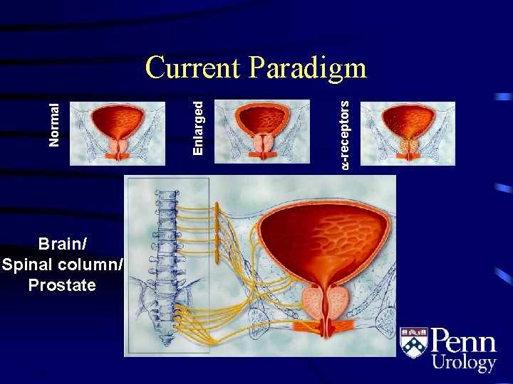 Brain/ Spinal column/ Prostate 2. 4 -receptors Enlarged Normal Current Paradigm 