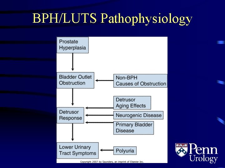 BPH/LUTS Pathophysiology 