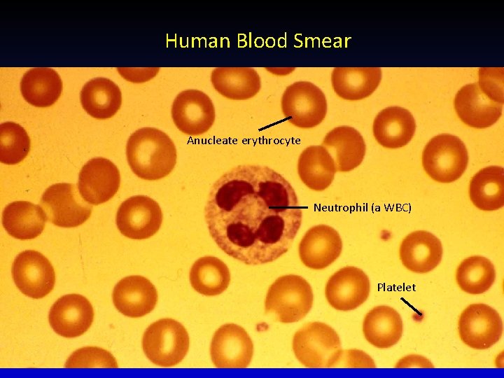 Human Blood Smear Anucleate erythrocyte Neutrophil (a WBC) Platelet 