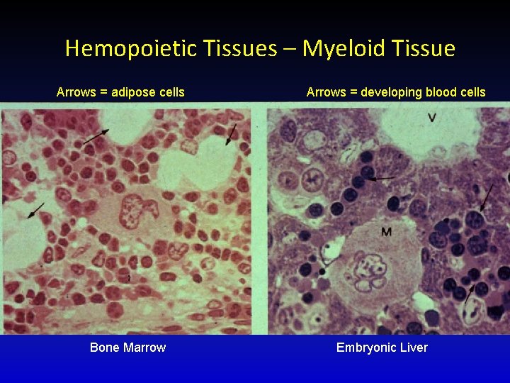 Hemopoietic Tissues – Myeloid Tissue Arrows = adipose cells Bone Marrow Arrows = developing