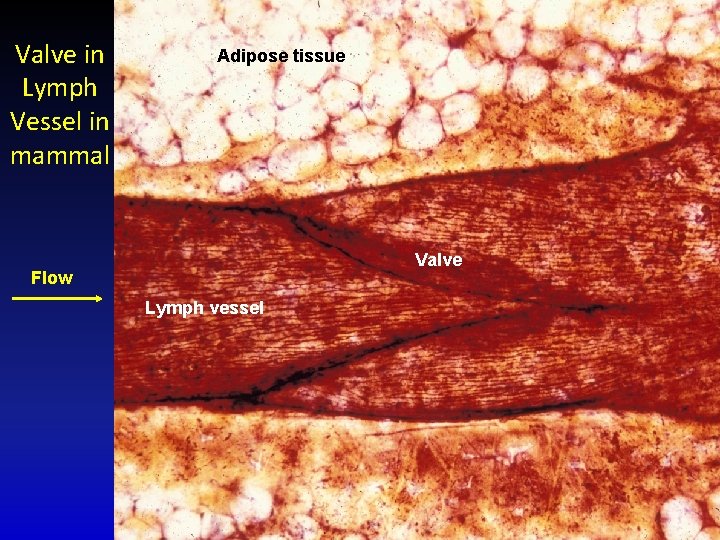 Valve in Lymph Vessel in mammal Adipose tissue Valve Flow Lymph vessel 