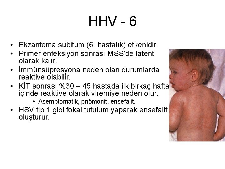 HHV - 6 • Ekzantema subitum (6. hastalık) etkenidir. • Primer enfeksiyon sonrası MSS’de