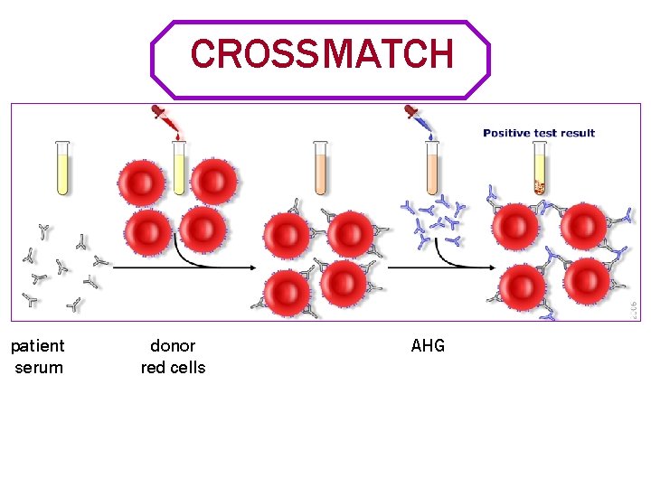 CROSSMATCH patient serum donor red cells AHG 