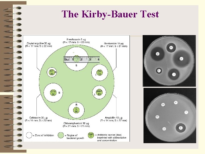 The Kirby-Bauer Test 