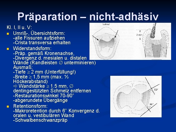 Präparation – nicht-adhäsiv Kl. I, II u. V: n Umriß-, Übersichtsform: -alle Fissuren aufziehen