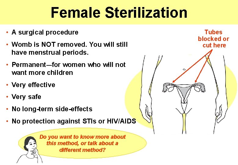 Female Sterilization • A surgical procedure • Womb is NOT removed. You will still
