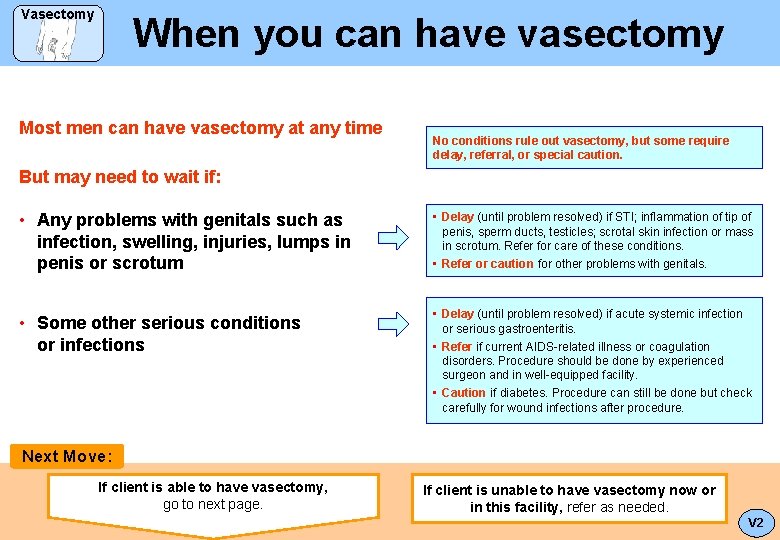 Vasectomy When you can have vasectomy Most men can have vasectomy at any time