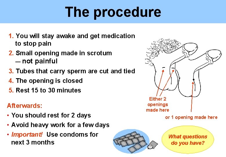 The procedure 1. You will stay awake and get medication to stop pain 2.