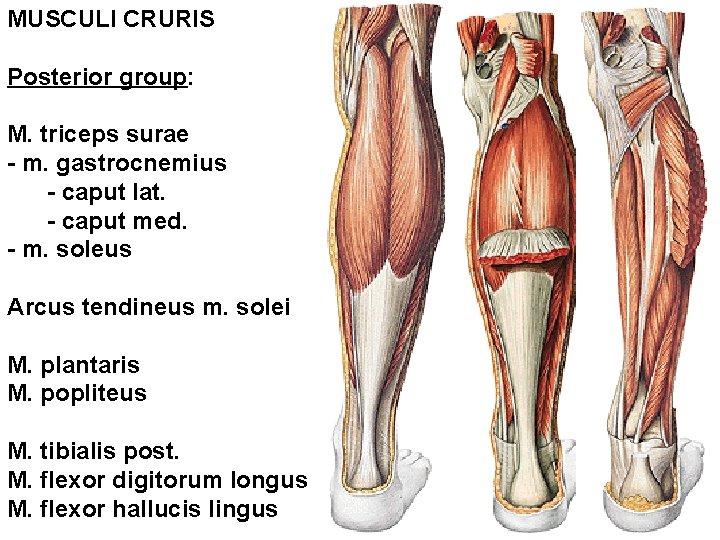 MUSCULI CRURIS Posterior group: M. triceps surae - m. gastrocnemius - caput lat. -