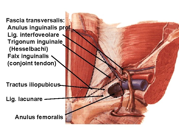 Fascia transversalis: Anulus inguinalis prof. Lig. interfoveolare Trigonum inguinale (Hesselbachi) Falx inguinalis (conjoint tendon)