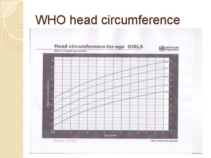 WHO head circumference 