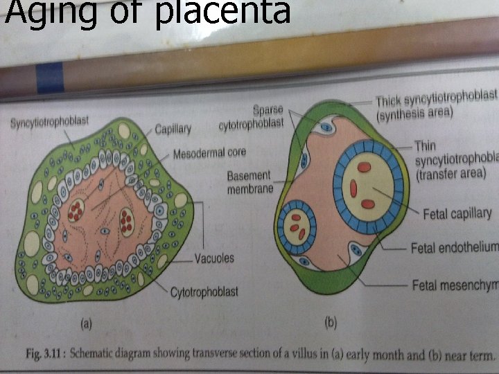 Aging of placenta 