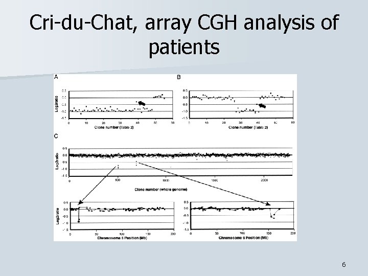 Cri-du-Chat, array CGH analysis of patients 6 