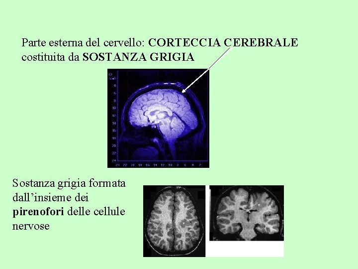 Parte esterna del cervello: CORTECCIA CEREBRALE costituita da SOSTANZA GRIGIA Sostanza grigia formata dall’insieme