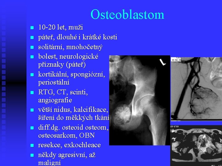 Osteoblastom n n n n n 10 -20 let, muži páteř, dlouhé i krátké
