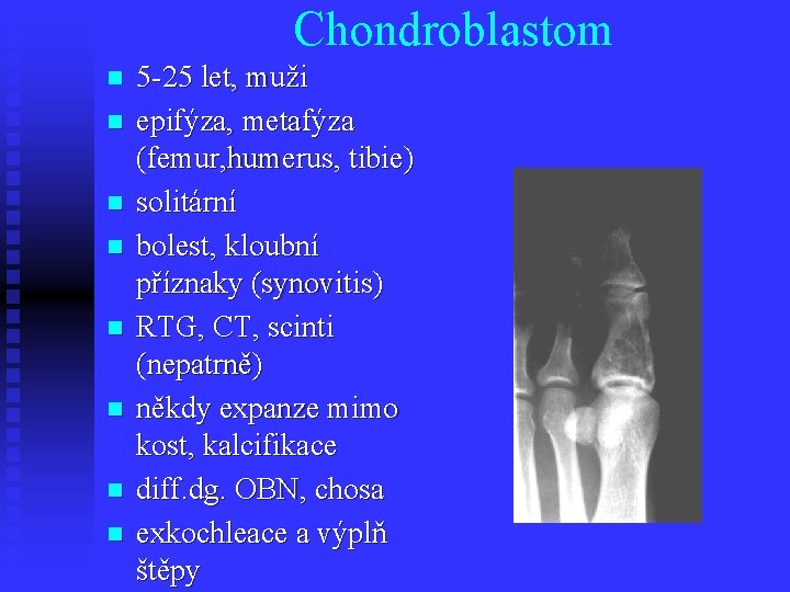 Chondroblastom n n n n 5 -25 let, muži epifýza, metafýza (femur, humerus, tibie)