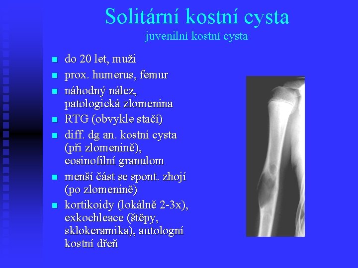 Solitární kostní cysta juvenilní kostní cysta n n n n do 20 let, muži