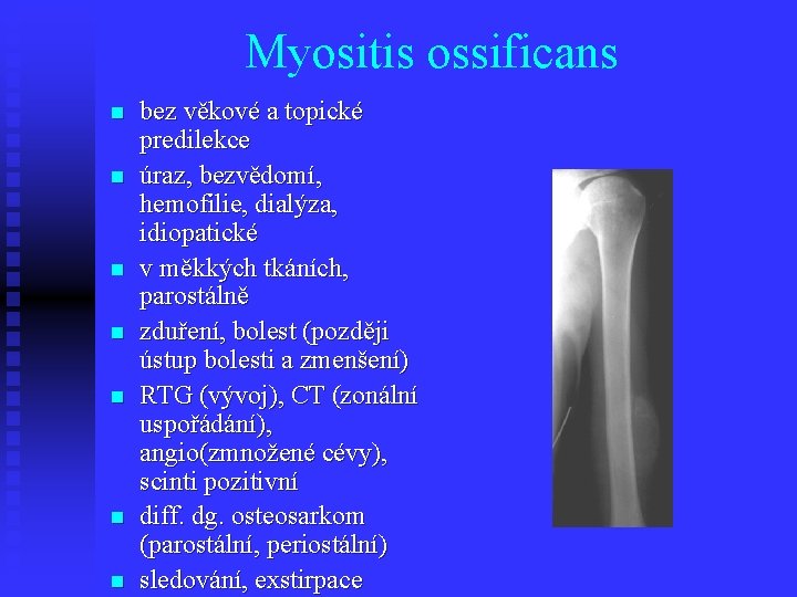 Myositis ossificans n n n n bez věkové a topické predilekce úraz, bezvědomí, hemofilie,