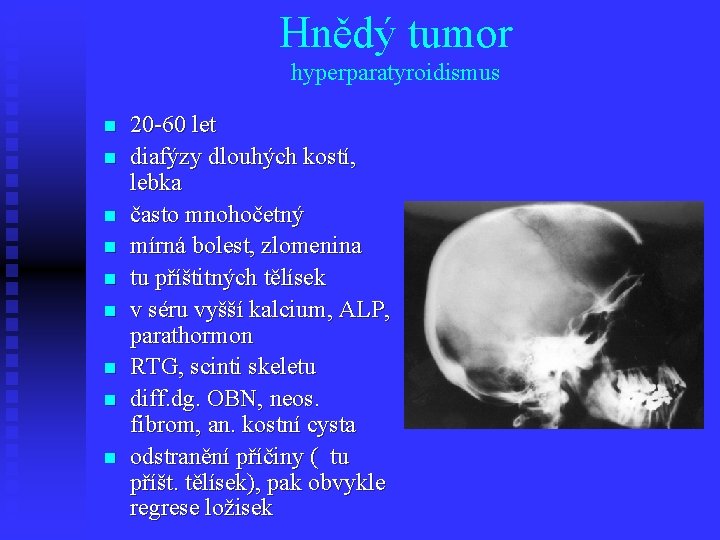 Hnědý tumor hyperparatyroidismus n n n n n 20 -60 let diafýzy dlouhých kostí,