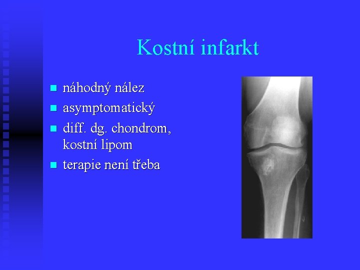 Kostní infarkt n n náhodný nález asymptomatický diff. dg. chondrom, kostní lipom terapie není