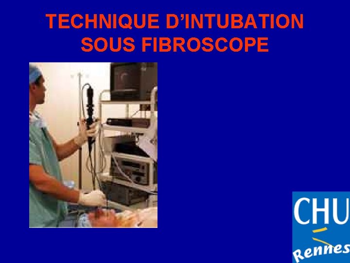 TECHNIQUE D’INTUBATION SOUS FIBROSCOPE 