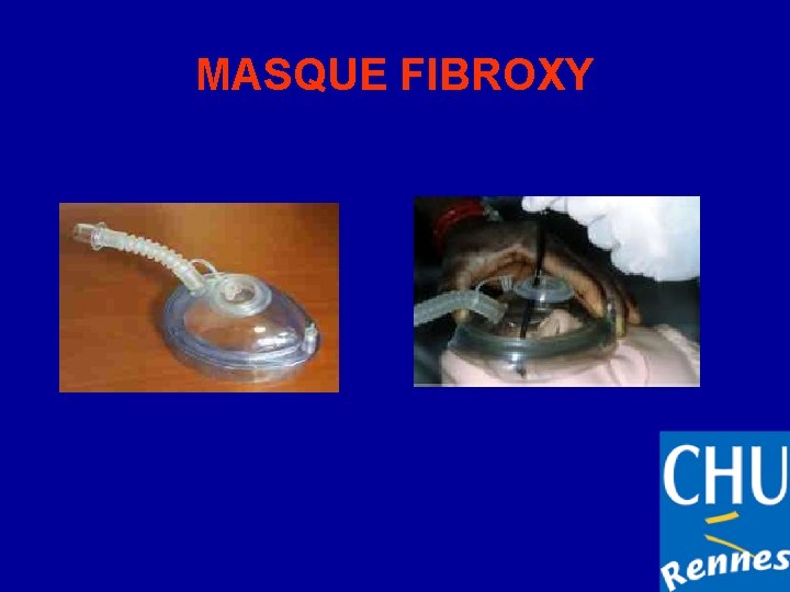 MASQUE FIBROXY 