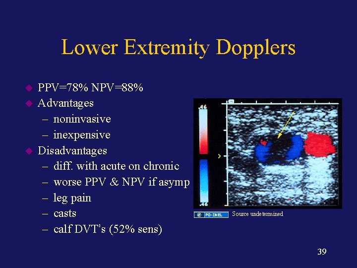 Lower Extremity Dopplers u u u PPV=78% NPV=88% Advantages – noninvasive – inexpensive Disadvantages