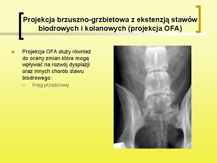 Projekcja brzuszno-grzbietowa z ekstenzją stawów biodrowych i kolanowych (projekcja OFA) n Projekcja OFA służy