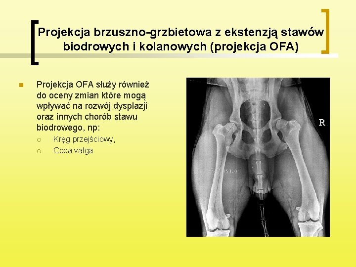 Projekcja brzuszno-grzbietowa z ekstenzją stawów biodrowych i kolanowych (projekcja OFA) n Projekcja OFA służy