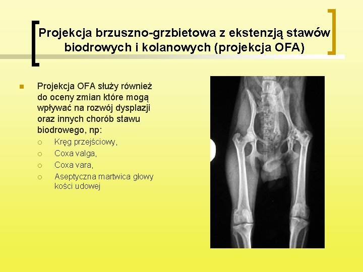 Projekcja brzuszno-grzbietowa z ekstenzją stawów biodrowych i kolanowych (projekcja OFA) n Projekcja OFA służy