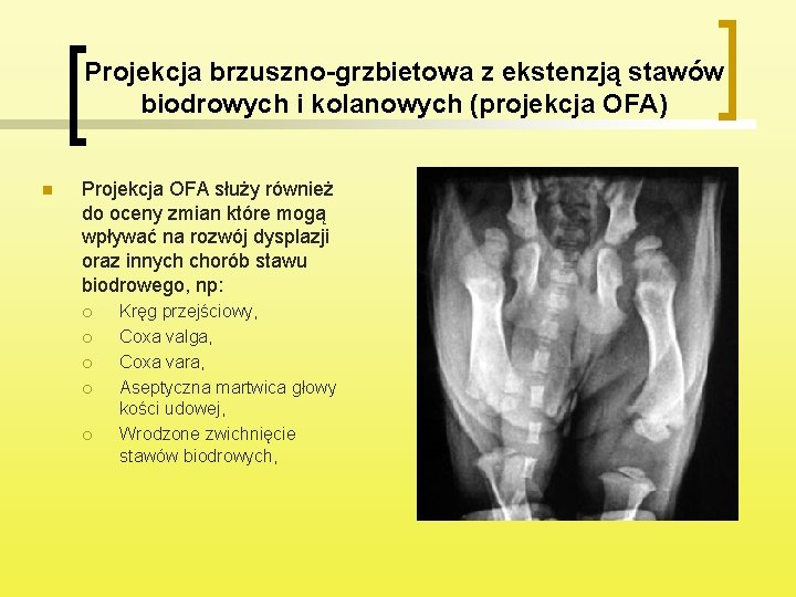 Projekcja brzuszno-grzbietowa z ekstenzją stawów biodrowych i kolanowych (projekcja OFA) n Projekcja OFA służy