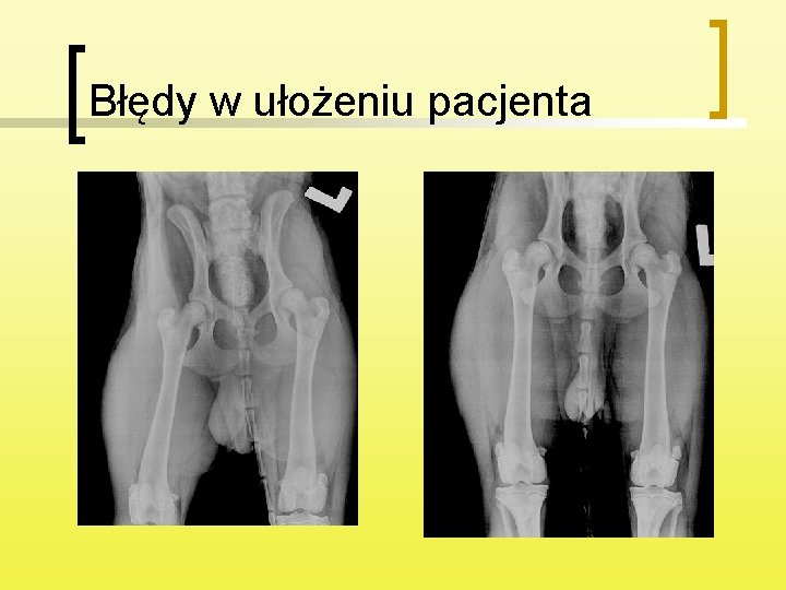 Błędy w ułożeniu pacjenta 