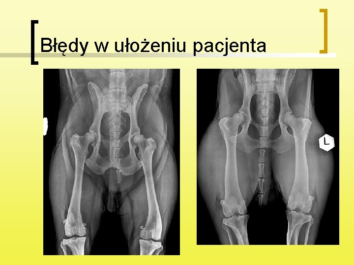 Błędy w ułożeniu pacjenta 