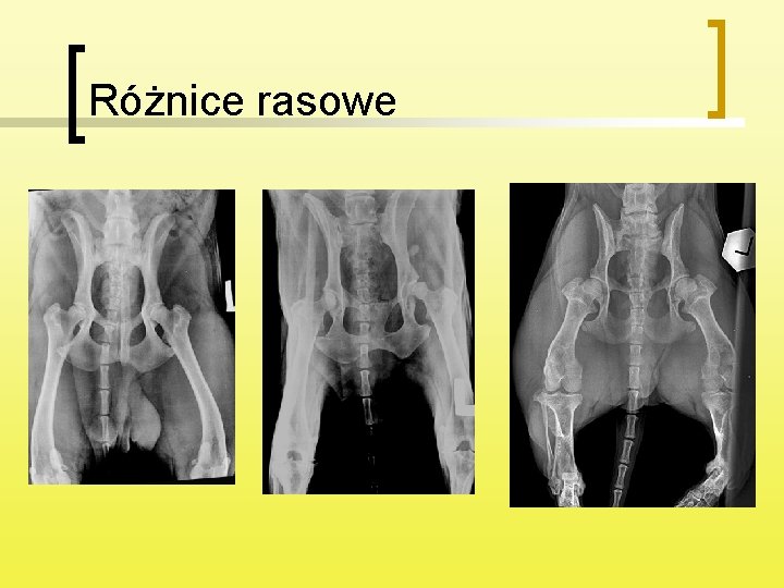 Różnice rasowe 