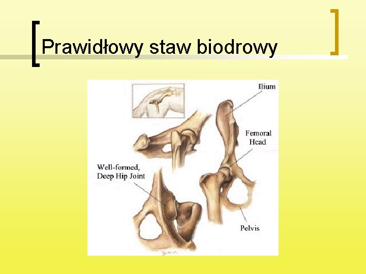 Prawidłowy staw biodrowy 