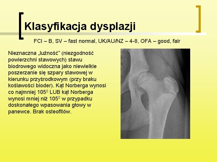 Klasyfikacja dysplazji FCI – B, SV – fast normal, UK/AU/NZ – 4 -8, OFA