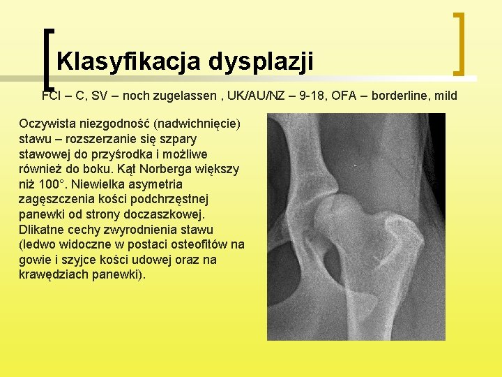 Klasyfikacja dysplazji FCI – C, SV – noch zugelassen , UK/AU/NZ – 9 -18,
