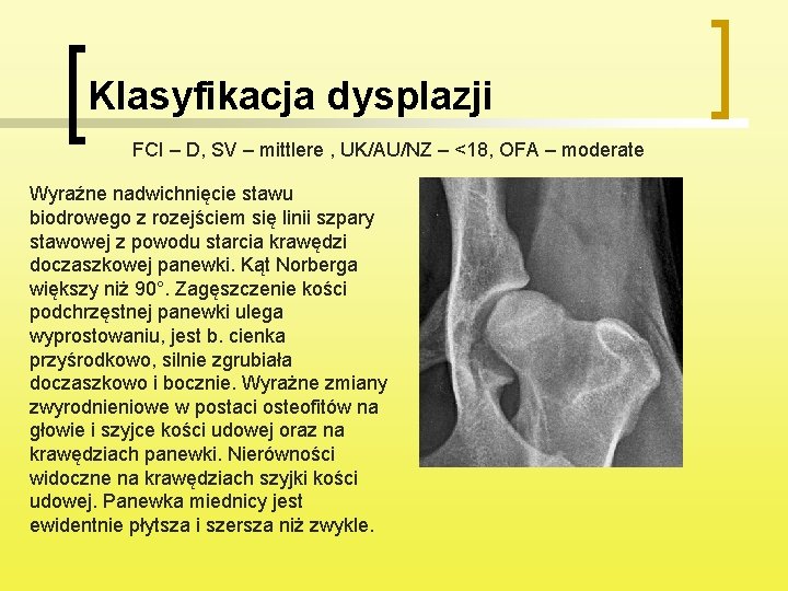 Klasyfikacja dysplazji FCI – D, SV – mittlere , UK/AU/NZ – <18, OFA –