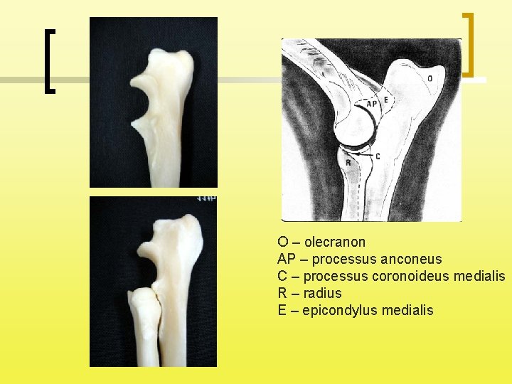 O – olecranon AP – processus anconeus C – processus coronoideus medialis R –