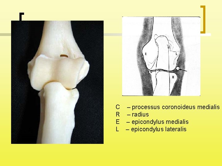 C – processus coronoideus medialis R – radius E – epicondylus medialis L –