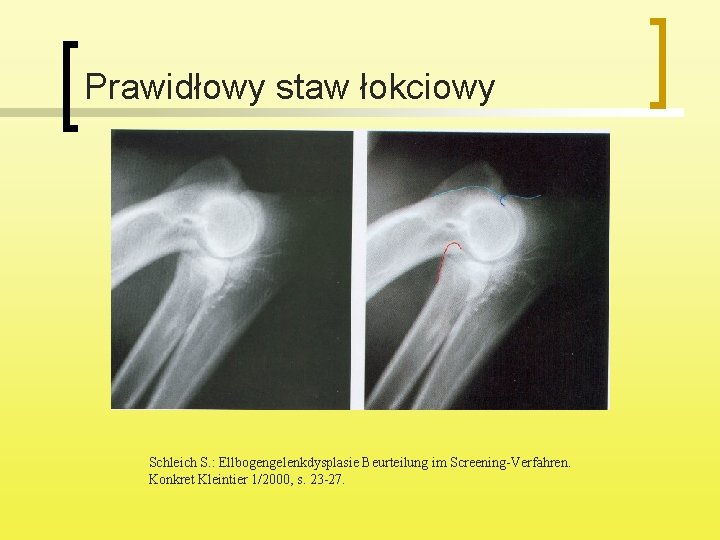 Prawidłowy staw łokciowy Schleich S. : Ellbogengelenkdysplasie Beurteilung im Screening-Verfahren. Konkret Kleintier 1/2000, s.
