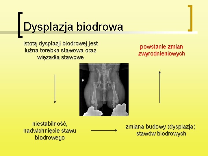 Dysplazja biodrowa istotą dysplazji biodrowej jest luźna torebka stawowa oraz więzadła stawowe niestabilność, nadwichnięcie