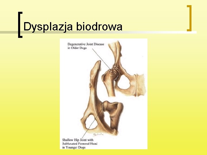 Dysplazja biodrowa 