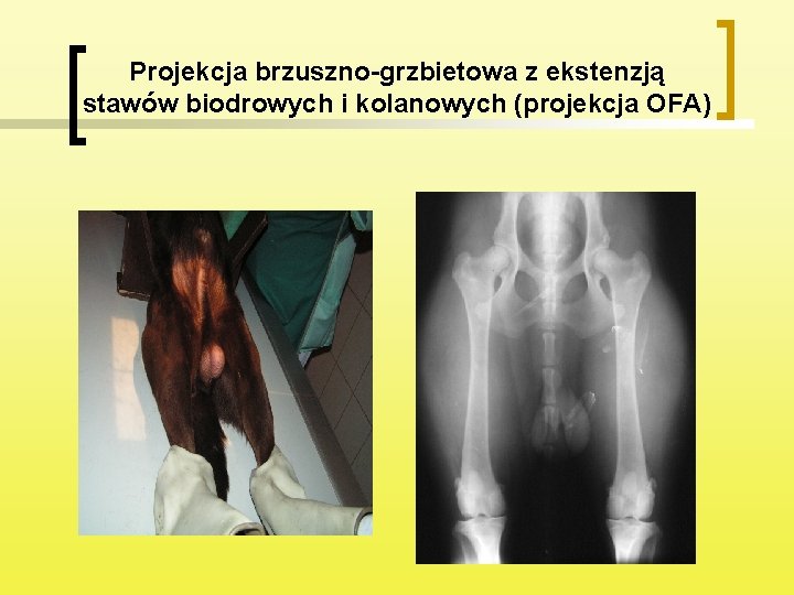 Projekcja brzuszno-grzbietowa z ekstenzją stawów biodrowych i kolanowych (projekcja OFA) 