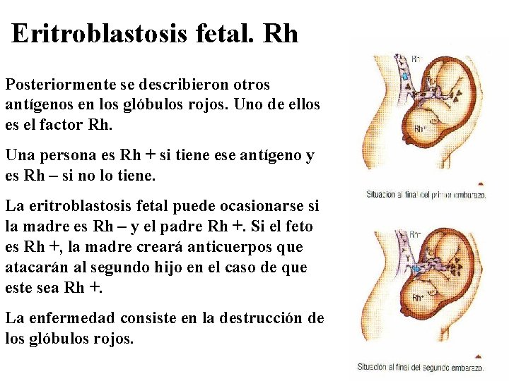 Eritroblastosis fetal. Rh Posteriormente se describieron otros antígenos en los glóbulos rojos. Uno de