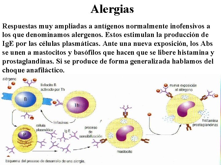 Alergias Respuestas muy ampliadas a antígenos normalmente inofensivos a los que denominamos alergenos. Estos